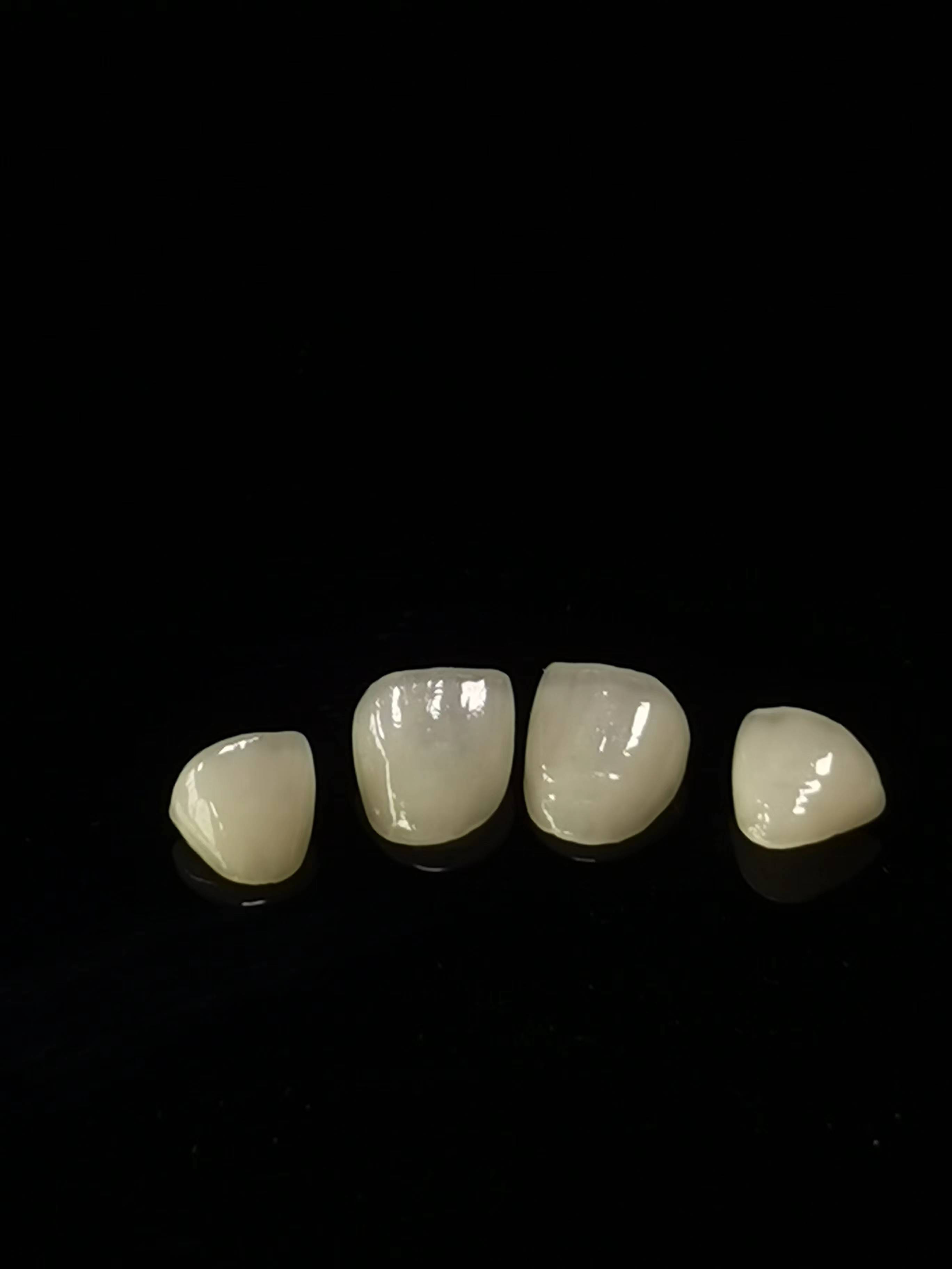E.max 歯科技工所の仕事