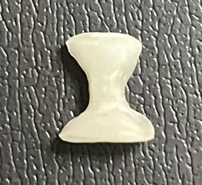 インレーとは何ですか?