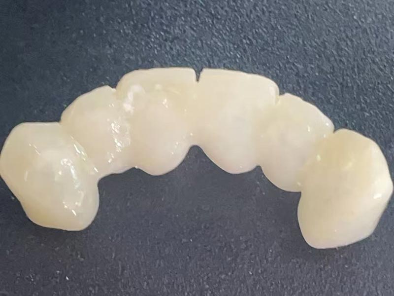 「一時的なクラウン」とは何ですか？なぜ必要なのでしょうか?