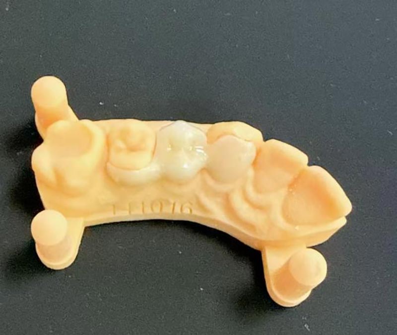 メリーランド橋について知っておくべきことは何ですか?