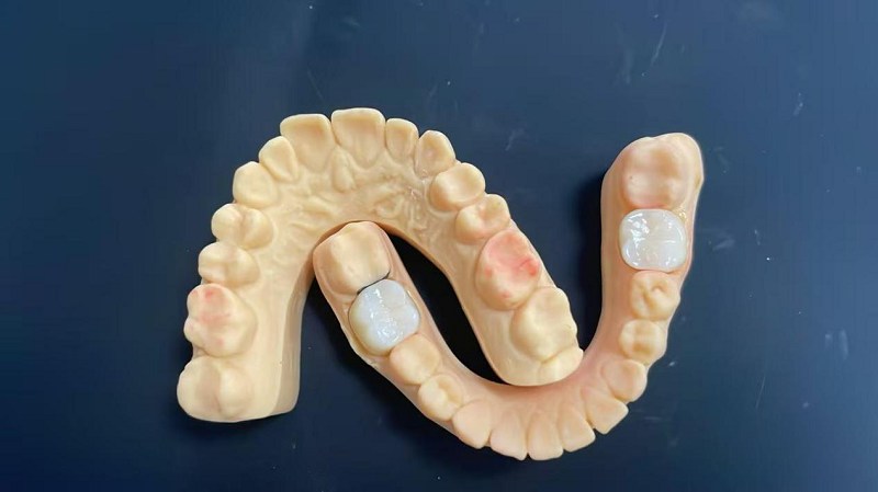 ショルダーエッジとは何ですか？